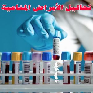 مختبر - مختبر تحاليل - مختبر تحاليل طبية - بالكويت 60900553 - رقم مختبر - تحاليل منزلية - مختبر تحاليل الكويت - مختبر تحاليل خدمة منازل - ارخص مختبر تحاليل بالكويت - مختبر تحليل دم ٢٤ ساعة - افضل مختبر تحاليل في الكويت 21 تحاليل الامراض المناعية