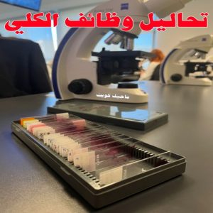 مختبر - مختبر تحاليل - مختبر تحاليل طبية - بالكويت 60900553 - رقم مختبر - تحاليل منزلية - مختبر تحاليل الكويت - مختبر تحاليل خدمة منازل - ارخص مختبر تحاليل بالكويت - مختبر تحليل دم ٢٤ ساعة - افضل مختبر تحاليل في الكويت 16 تحاليل وظائف الكلى