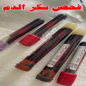 مختبر - مختبر تحاليل - مختبر تحاليل طبية - بالكويت 60900553 - رقم مختبر - تحاليل منزلية - مختبر تحاليل الكويت - مختبر تحاليل خدمة منازل - ارخص مختبر تحاليل بالكويت - مختبر تحليل دم ٢٤ ساعة - افضل مختبر تحاليل في الكويت 12 فحص سكر الدم