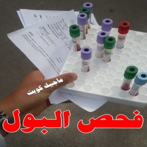 مختبر - مختبر تحاليل - مختبر تحاليل طبية - بالكويت 60900553 - رقم مختبر - تحاليل منزلية - مختبر تحاليل الكويت - مختبر تحاليل خدمة منازل - ارخص مختبر تحاليل بالكويت - مختبر تحليل دم ٢٤ ساعة - افضل مختبر تحاليل في الكويت 10 فحص البول