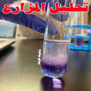 مختبر - مختبر تحاليل - مختبر تحاليل طبية - بالكويت 60900553 - رقم مختبر - تحاليل منزلية - مختبر تحاليل الكويت - مختبر تحاليل خدمة منازل - ارخص مختبر تحاليل بالكويت - مختبر تحليل دم ٢٤ ساعة - افضل مختبر تحاليل في الكويت 19 تحليل المزارع
